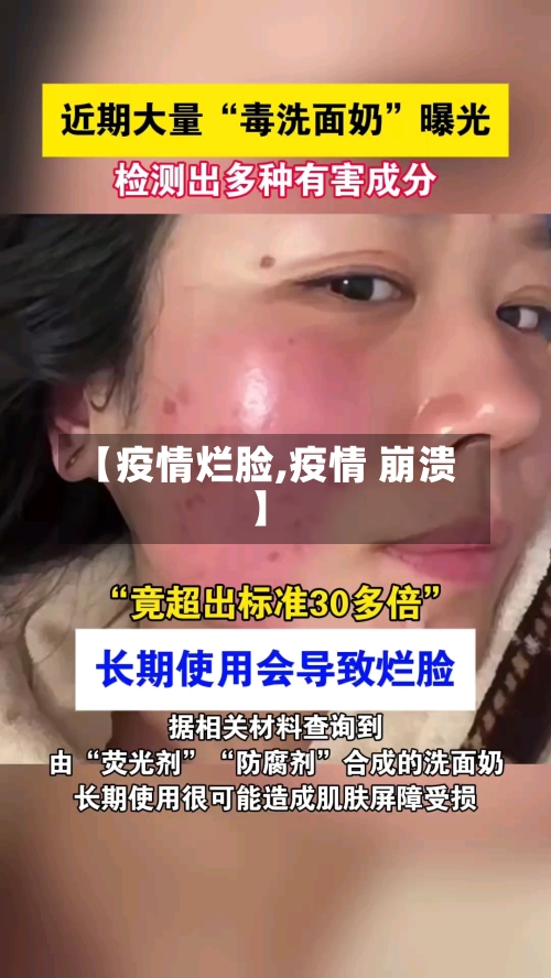 【疫情烂脸,疫情 崩溃】