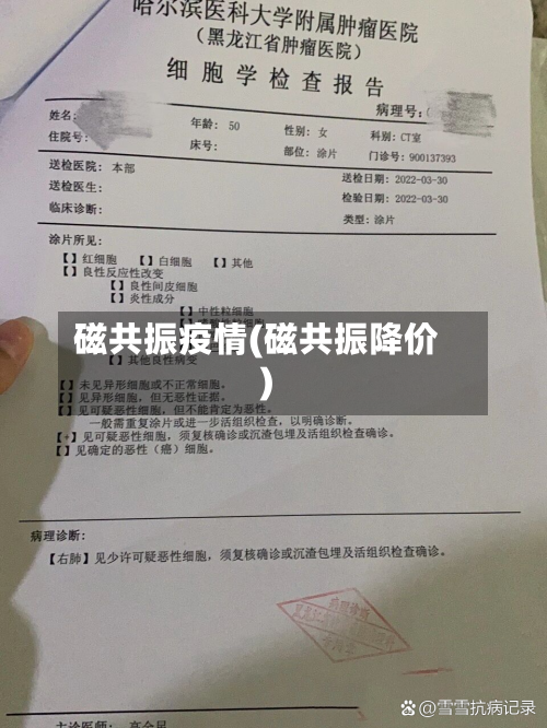 磁共振疫情(磁共振降价)-第2张图片