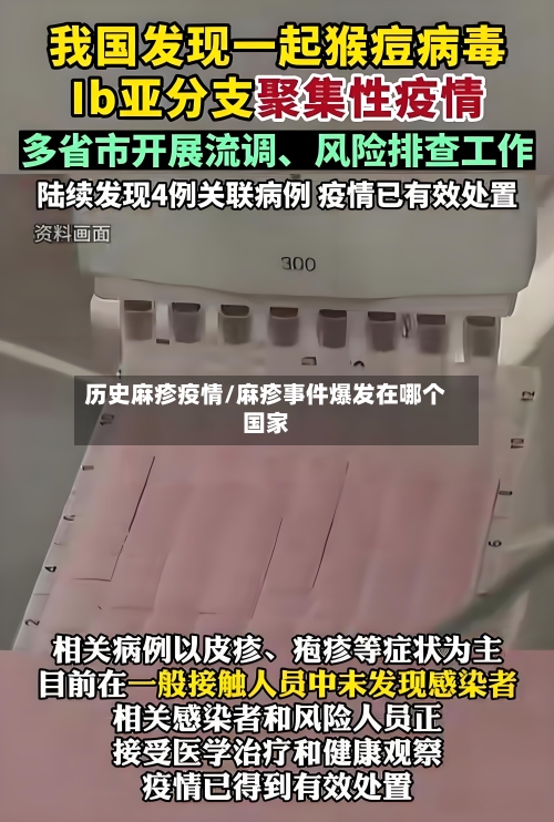 历史麻疹疫情/麻疹事件爆发在哪个国家-第3张图片