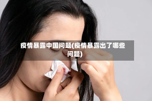 疫情暴露中国问题(疫情暴露出了哪些问题)
