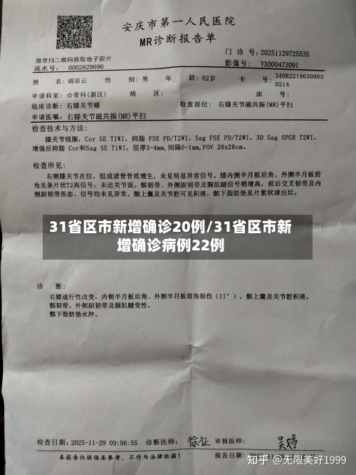 31省区市新增确诊20例/31省区市新增确诊病例22例-第2张图片